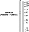 Western blot analysis of extracts from JK cells using MAPK1/3 (Phospho-Tyr205/222) Antibody.The lane on the right is treated with the antigen-specific peptide.