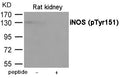 Western blot analysis of extracts from Rat kindey using iNOS (Phospho-Tyr151) Antibody.The lane on the right is treated with the antigen-specific peptide.