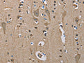 The image on the left is immunohistochemistry of paraffin-embedded Human brain tissue using CSB-PA213997(SERPINA1 Antibody) at dilution 1/50, on the right is treated with fusion protein. (Original magnification: ×200)
