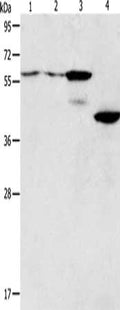 Gel: 10%SDS-PAGE, Lysate: 40 ug, Lane 1-4: A375 cells, A172 cells, mouse pancreas tissue, human liver cancer tissue, Primary antibody: CSB-PA214066(PGBD2 Antibody) at dilution 1/550, Secondary antibody: Goat anti rabbit IgG at 1/8000 dilution, Exposure time: 20 seconds