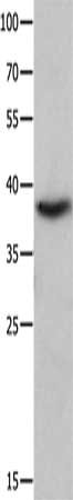 Gel: 10%SDS-PAGE, Lysate: 40 ug, Lane: NIH/3T3 cells, Primary antibody: CSB-PA214200(CTSV Antibody) at dilution 1/100, Secondary antibody: Goat anti rabbit IgG at 1/8000 dilution, Exposure time: 3 seconds