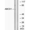 Western blot analysis of extracts from Jurkat cells, using ABCD1 antibody.