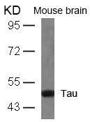 Western blot analysis of extracts from mouse brain tissue using Tau(Ab-404) Antibody.