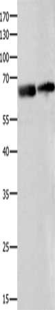 Gel: 8%SDS-PAGE, Lysate: 40 ug, Lane 1-2: Human liver tissue, Human ovarian cancer tissue, Primary antibody: CSB-PA215752(IGF2BP2 Antibody) at dilution 1/300, Secondary antibody: Goat anti rabbit IgG at 1/8000 dilution, Exposure time: 2 minutes