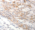 Immunohistochemical analysis of paraffin-embedded Human lung cancer tissue using.