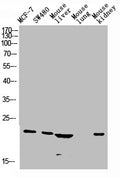 Western blot analysis of Jurkat U937 Raji mouse-eye lysate, antibody was diluted at 1000. Secondary antibody  was diluted at 1:20000