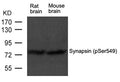 Western blot analysis of extract from rat brain and mouse brain tissue using Synapsin(phospho-Ser549) Antibody using