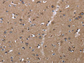 The image on the left is immunohistochemistry of paraffin-embedded Human brain tissue using CSB-PA216811(CLDN23 Antibody) at dilution 1/30, on the right is treated with fusion protein. (Original magnification: ×200)