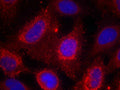 Immunofluorescence staining of methanol-fixed Hela cells using TrkA(Ab-791) Antibody.