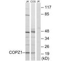 Western blot analysis of extracts from Jurkat cells and COS cells, using COPZ1 antibody.
