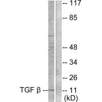 Western blot analysis of extracts from COS7 cells, using TGF β3 antibody.