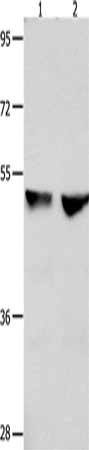 Gel: 8%SDS-PAGE, Lysate: 40 ug, Lane 1-2: 823 cells, Hela cells, Primary antibody: CSB-PA217262(CDK9 Antibody) at dilution 1/300, Secondary antibody: Goat anti rabbit IgG at 1/8000 dilution, Exposure time: 40 seconds