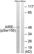 Western blot analysis of extracts from HeLa cells treated with Hu using AIRE (Phospho-Ser156) Antibody.The lane on the right is treated with the antigen-specific peptide.