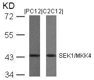 Western blot analysis of extracts from PC12 and C2C12 cells using SEK1/MKK4(Ab-80) Antibody.