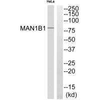 Western blot analysis of extracts from Hala cells, using MAN1B1 antibody.