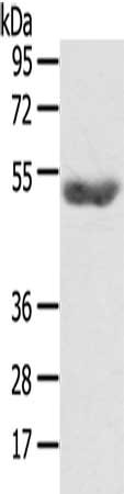 Gel: 8%SDS-PAGE, Lysate: 40 ug, Lane: Mouse plasma tissue, Primary antibody: CSB-PA218593(AGPAT6  Antibody) at dilution 1/400, Secondary antibody: Goat anti rabbit IgG at 1/8000 dilution, Exposure time: 5 minutes