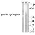 Western blot analysis of extracts from 3T3 cells treated with Forskolin (40nM, 30min), using Tyrosine Hydroxylase (Ab-19) antibody.