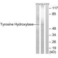 Western blot analysis of extracts from 3T3 cells treated with Forskolin (40nM, 30min), using Tyrosine Hydroxylase (Ab-19) antibody.