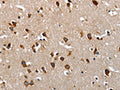 The image on the left is immunohistochemistry of paraffin-embedded Human brain tissue using CSB-PA219638(LAMA1 Antibody) at dilution 1/70, on the right is treated with synthetic peptide. (Original magnification: ×200)