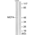 Western blot analysis of extracts from LOVO cells, using MOT4 antibody.