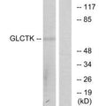 Western blot analysis of extracts from 3T3 cells, using GLCTK antibody.