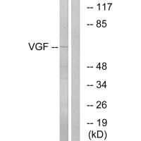 Western blot analysis of extracts from RAW264.7 cells, using VGF antibody.