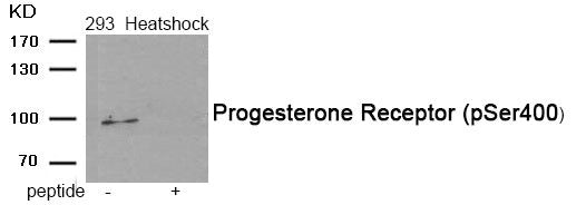 Western blot analysis of extracts from 293 cells treated with Heatshock using Phospho-Progesterone Receptor (Ser400) antibody.The lane on the right is treated with the antigen-specific peptide.