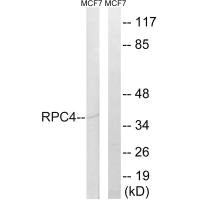 Western blot analysis of extracts from MCF-7 cells, using RPC4 antibody.