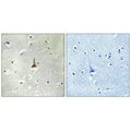 Immunohistochemistry analysis of paraffin-embedded human brain tissue using LRP10 antibody.