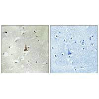 Immunohistochemistry analysis of paraffin-embedded human brain tissue using LRP10 antibody.