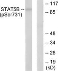 Western blot analysis of extracts from RAW264.7 cells, treated with EGF (200ng/ml, 30mins), using STAT5B (phospho-Ser731) antibody. The lane on the right is treated with the synthesized peptide.