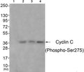 Western blot analysis of extracts from 3T3 cells (Lane 2), A549 cells (Lane 3) and Hela cells (Lane 4), using Cyclin C (Phospho-Ser275) Antibody. The lane on the left is treated with antigen-specific peptide.
