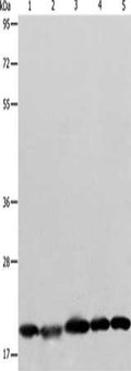Gel: 8+12%SDS-PAGE, Lysate: 40 ug, Lane 1-5: Human brain malignant glioma tissue, MCF7 cells, Raji cells, Lovo cells, 293T cells, Primary antibody: CSB-PA221042(BAX Antibody) at dilution 1/426, Secondary antibody: Goat anti rabbit IgG at 1/8000 dilution, Exposure time: 7 seconds