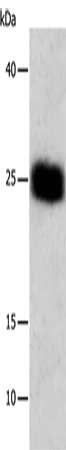 Gel: 12+15%SDS-PAGE, Lysate: 30 ug, Lane: Human cervical cancer tissue, Primary antibody: CSB-PA223208(BCL2L1 Antibody) at dilution 1/450, Secondary antibody: Goat anti rabbit IgG at 1/8000 dilution, Exposure time: 10 seconds