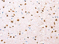 The image on the left is immunohistochemistry of paraffin-embedded Human brain tissue using CSB-PA223323(ESR1 Antibody) at dilution 1/76, on the right is treated with synthetic peptide. (Original magnification: ×200)