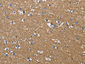 The image on the left is immunohistochemistry of paraffin-embedded Human brain tissue using CSB-PA223691(GPM6A Antibody) at dilution 1/50, on the right is treated with fusion protein. (Original magnification: ×200)