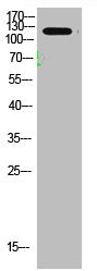 Western Blot analysis of mouse-brain cells using primary antibody diluted at 1:1000(4°C overnight). Secondary antibody:Goat Anti-rabbit IgG IRDye 800( diluted at 1:5000, 25°C, 1 hour)