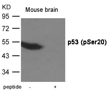 Western blot analysis of extracts from  Mouse brain tissue using p53 (Phospho-Ser20) Antibody.The lane on the right is treated with the antigen-specific peptide.