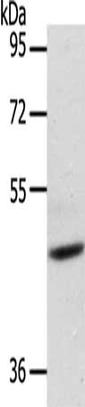 Gel: 8%SDS-PAGE, Lysate: 40 ug, Lane: Mouse heart tissue, Primary antibody: CSB-PA226584(ADIPOR1 Antibody) at dilution 1/200, Secondary antibody: Goat anti rabbit IgG at 1/8000 dilution, Exposure time: 30 seconds