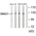 Western blot analysis of extracts from HeLa cells, Jurkat cells, 293 cells and HUVEC cells, using SMG7 antibody.
