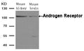 Western blot analysis of extracts from Mouse kindey and brain tissue using Androgen Receptor (Ab-650) Antibody.