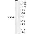 Western blot analysis of extracts from K562 cells, using APOE antibody.