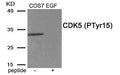 Western blot analysis of extracts from COS7 cells treated with EGF using Phospho-CDK5 (Tyr15) antibody.The lane on the right is treated with the antigen-specific peptide.