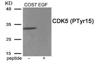 Western blot analysis of extracts from COS7 cells treated with EGF using Phospho-CDK5 (Tyr15) antibody.The lane on the right is treated with the antigen-specific peptide.