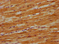 IHC image of CSB-PA22849A0Rb diluted at 1:300 and staining in paraffin-embedded human heart tissue performed on a Leica BondTM system. After dewaxing and hydration, antigen retrieval was mediated by high pressure in a citrate buffer (pH 6.0). Section was blocked with 10% normal goat serum 30min at RT. Then primary antibody (1% BSA) was incubated at 4°C overnight. The primary is detected by a biotinylated secondary antibody and visualized using an HRP conjugated SP system.