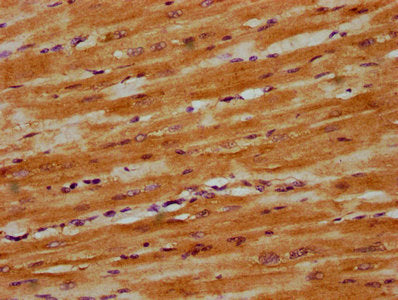 IHC image of CSB-PA22849A0Rb diluted at 1:300 and staining in paraffin-embedded human heart tissue performed on a Leica BondTM system. After dewaxing and hydration, antigen retrieval was mediated by high pressure in a citrate buffer (pH 6.0). Section was blocked with 10% normal goat serum 30min at RT. Then primary antibody (1% BSA) was incubated at 4°C overnight. The primary is detected by a biotinylated secondary antibody and visualized using an HRP conjugated SP system.