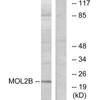 Western blot analysis of extracts from COLO cells, using MOL2B antibody.