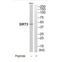 Western blot analysis of extracts from COLO205 cells, using SIRT3 antibody.