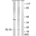 Western blot analysis of extracts from COLO cells and HeLa cells, using RPL18 antibody.