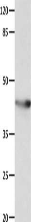 Gel: 10%SDS-PAGE, Lysate: 40 ug, Lane: Mouse spleen tissue, Primary antibody: CSB-PA229768(KCNA5 Antibody) at dilution 1/700, Secondary antibody: Goat anti rabbit IgG at 1/8000 dilution, Exposure time: 60 seconds